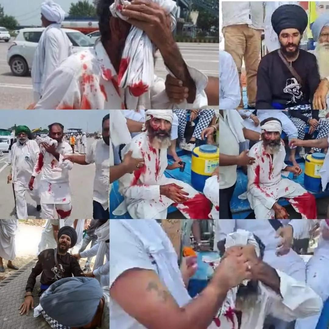 ਪੁਲਿਸ ਨੇ ਕਿਸਾਨਾਂ ਤੇ ਵਰ੍ਹਾਈਆਂ ਡਾਂਗਾਂ, ਕਿਸਾਨ ਹੋਏ ਲਹੂ-ਲੁਹਾਣ, ਗੱਡੀਆਂ ਦੇ ਸ਼ੀਸ਼ੇ ਵੀ ਟੁੱਟੇ, ਰਾਕੇਸ਼ ਟਿਕੈਤ ਵਲੋਂ ਘੋਰ ਨਿੰਦਾ