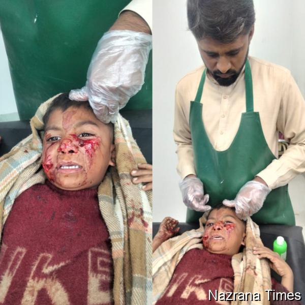 Panic Grips Border Areas of Shakargarh as Sudden Jackal Attacks Injure Multiple Residents